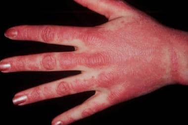 Causes and Risk Factors