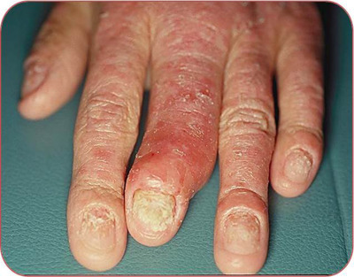 Causes and Risk Factors