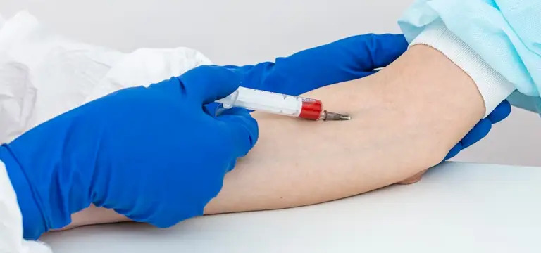 Tests for Diagnosing Rheumatoid Arthritis