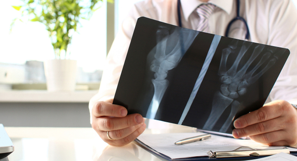 Tests for Osteoarthritis