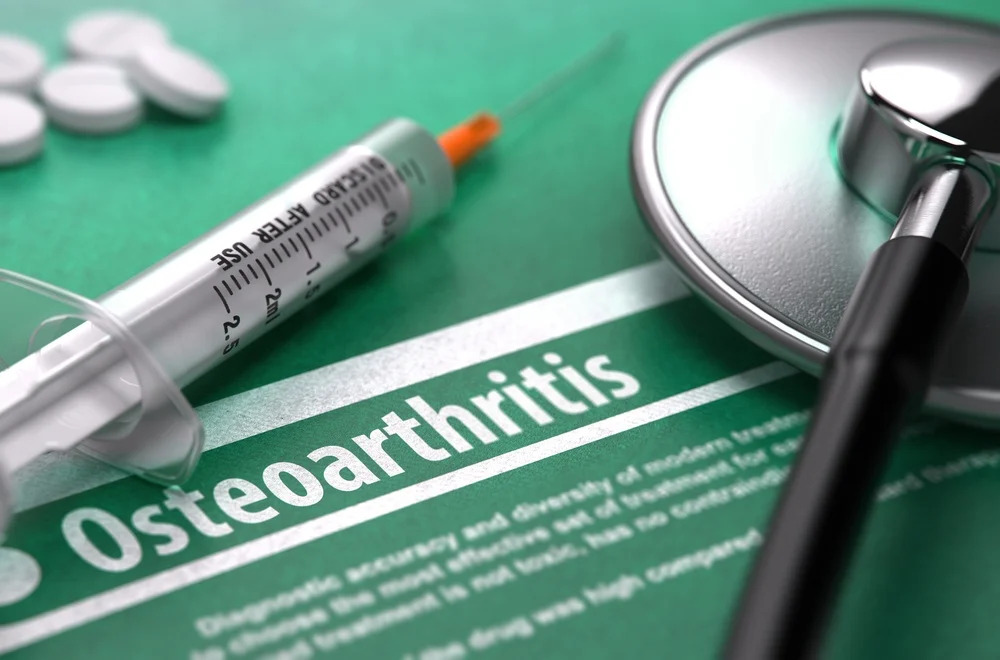 osteoarthritis-treatments
